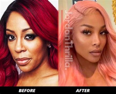k michelle before and after face